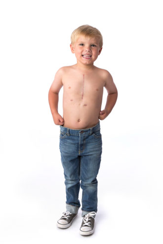 SUCCESS STORY: Abby Leonard’s newborn son, Walker, suffered from a rare congenital heart defect and wouldn’t survive long without open-heart surgery. Although duly warned against frantic googling, she needed to understand what was wrong with him. Her search produced two research papers on the defect; she read the first. A few days before Walker’s operation, Abby met Dr. Kris Guleserian at Children’s Medical Center in Dallas. “She was the first doctor to walk in and hug me. She said, ‘I’ll take care of him.’ After, my husband and I looked up the paper we read, and it was by Dr. G!” The surgery—the first of three; the final one was in June—went without a hitch. Walker is now 4 and in pre-K.