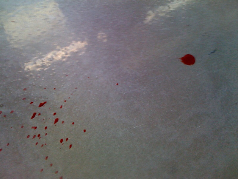 But at least Eric didn't bleed. Another member of the media whom I didn't recognize left some of his bodily fluids on the concourse at Cowboys Stadium.