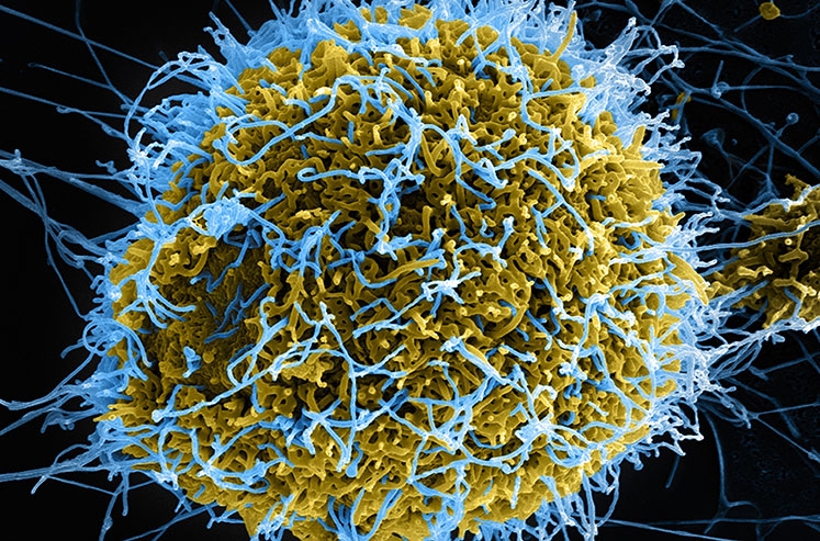 Ebola virus