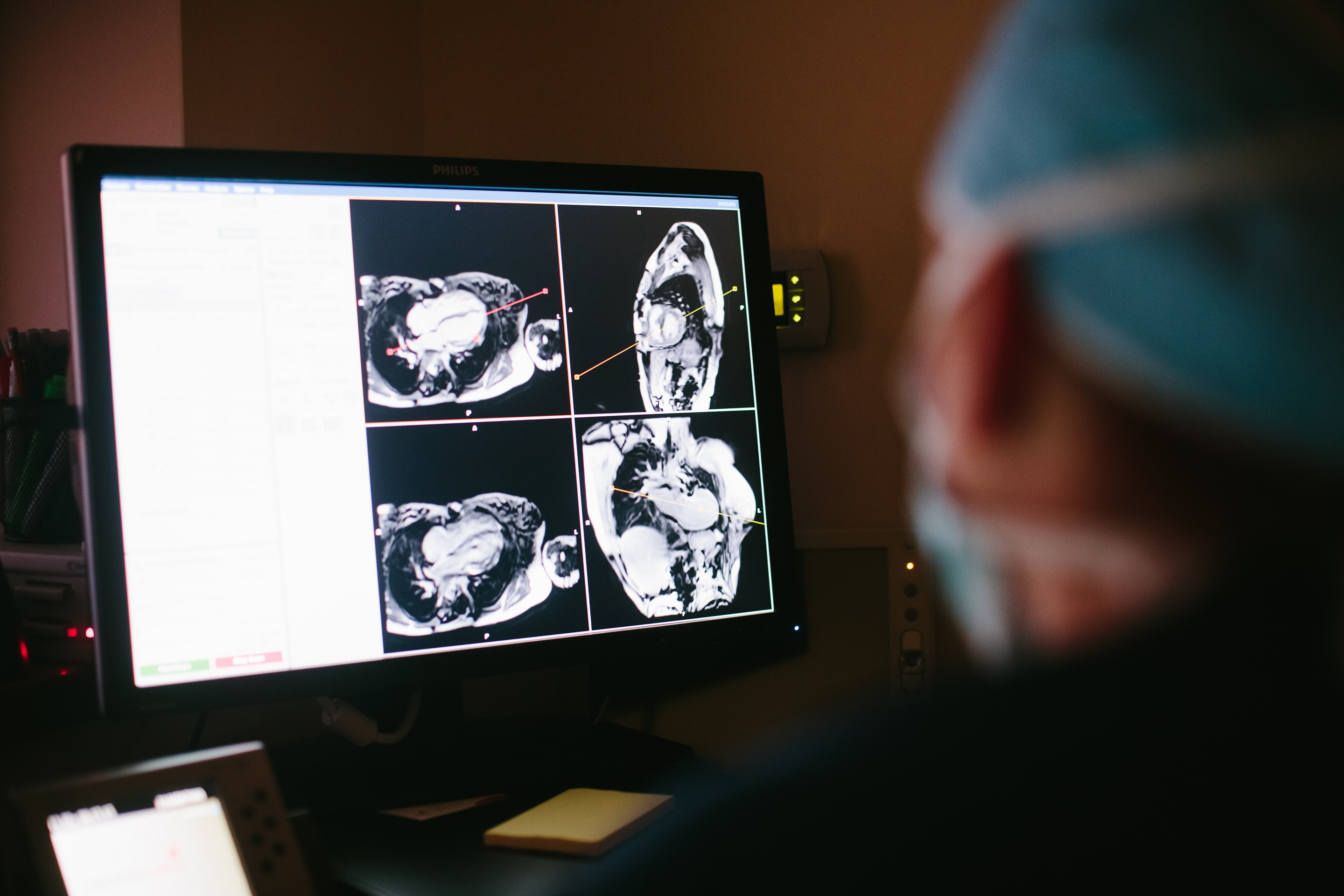 Children's Health Conducting DFW's First RadiationFree Cardiac Catheterization Procedures D