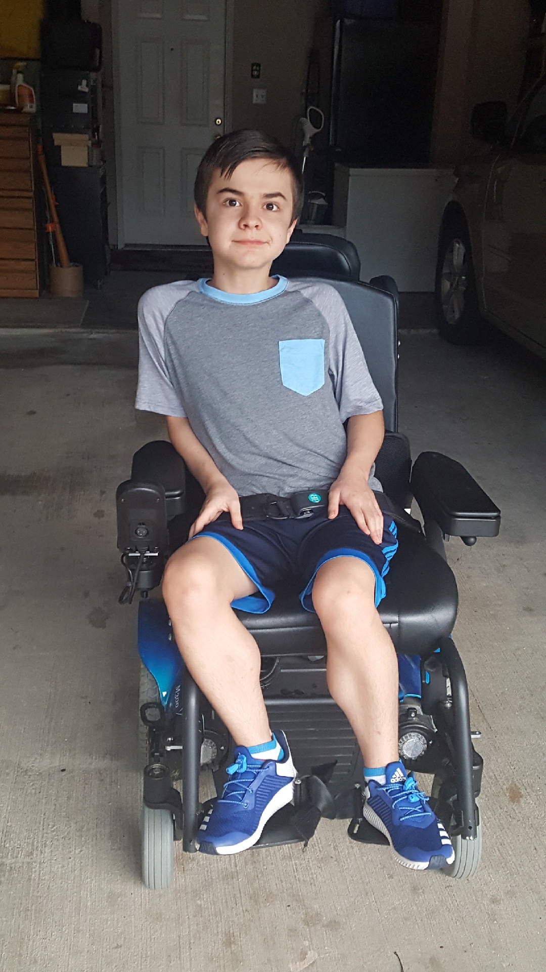 What Is The Life Expectancy Of A Boy With Duchenne Muscular Dystrophy