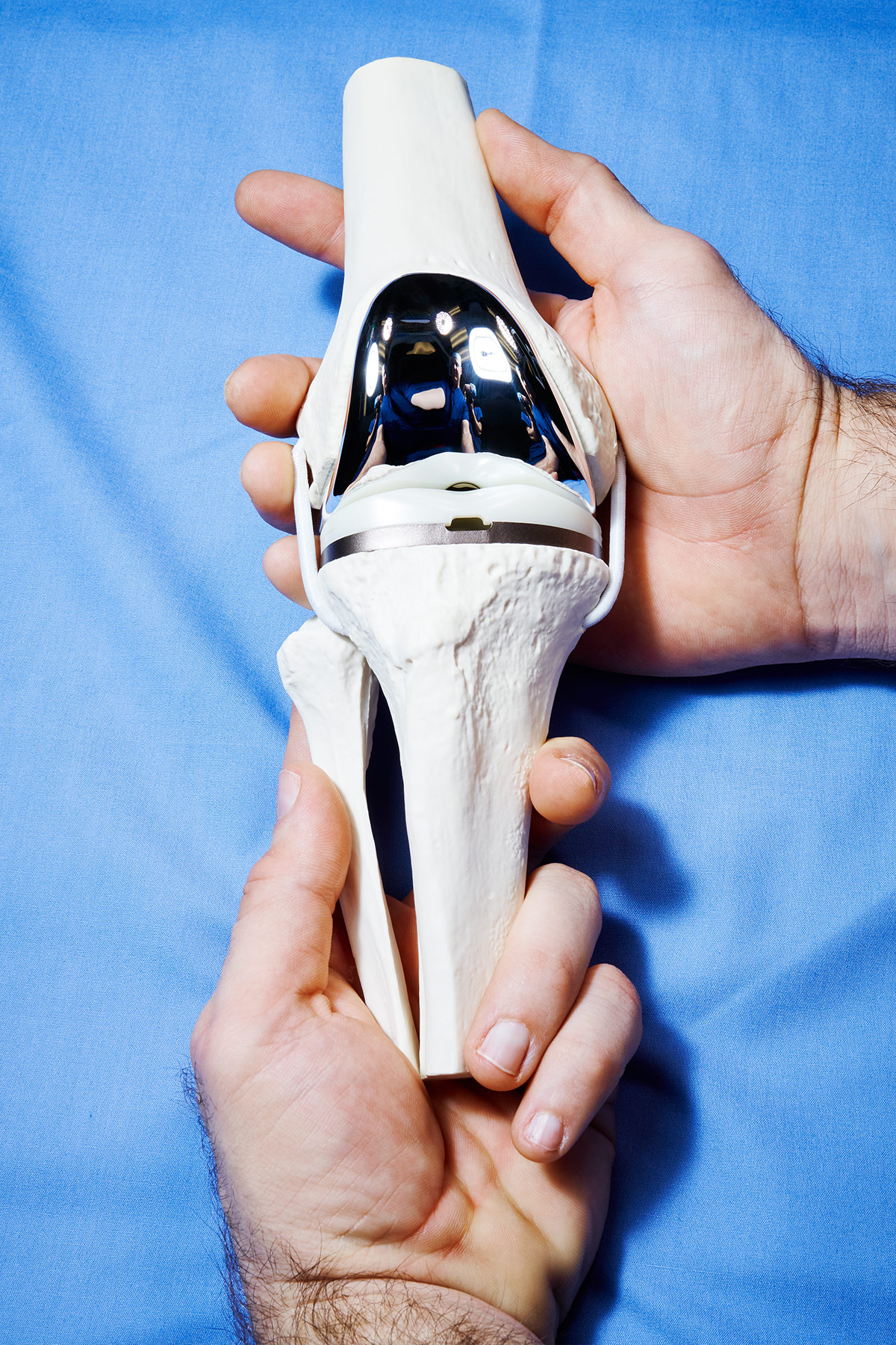 ROSA knee replacement technology