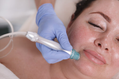 woman getting facial cosmetology treatment