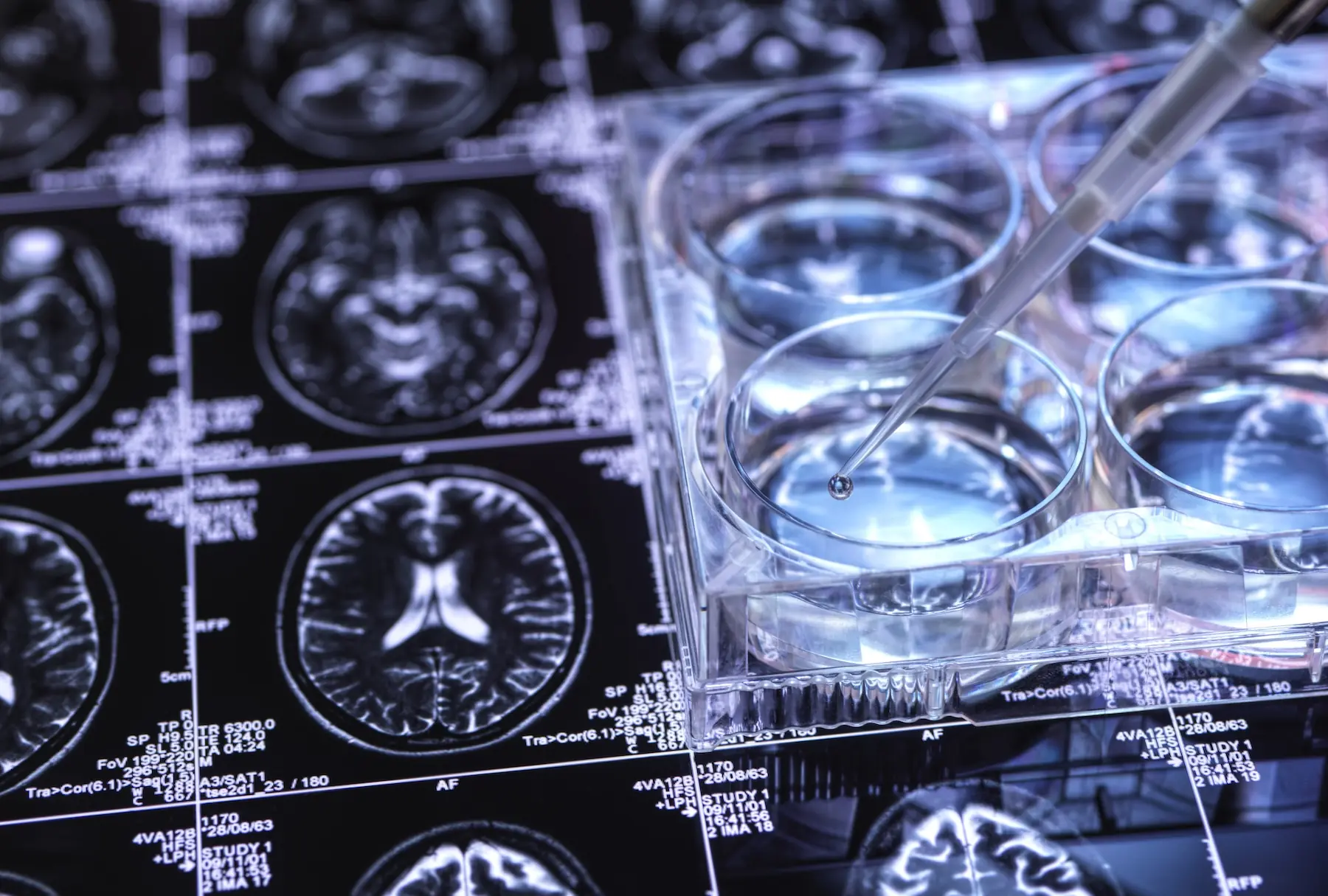 Rainwater Charitable Foundation Invests $3 Million in Neurodegenerative Diseases Research 