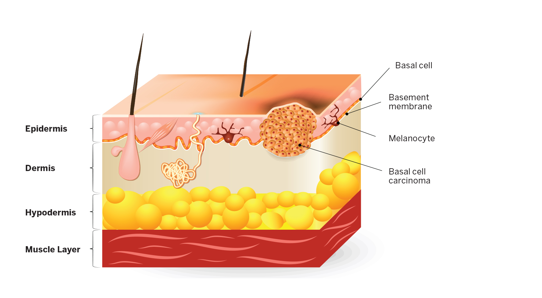 What You Need to Know About Skin Cancer - D Magazine